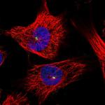 ZNF766 Polyclonal Antibody