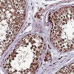 ZNF766 Antibody in Immunohistochemistry (Paraffin) (IHC (P))