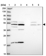 ZNF766 Antibody in Western Blot (WB)