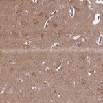 IA-6 Polyclonal Antibody