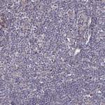 IA-6 Antibody in Immunohistochemistry (Paraffin) (IHC (P))