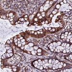 GIMAP1 Polyclonal Antibody