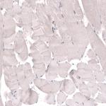 TMEM2 Antibody in Immunohistochemistry (Paraffin) (IHC (P))