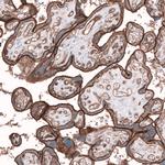 TMEM2 Antibody in Immunohistochemistry (IHC)