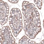 TMEM2 Antibody in Immunohistochemistry (IHC)