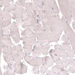 TMEM2 Antibody in Immunohistochemistry (IHC)