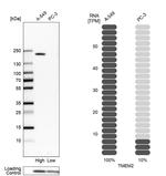 TMEM2 Antibody