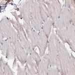 MTERF Antibody in Immunohistochemistry (Paraffin) (IHC (P))