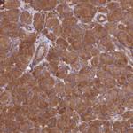 Dynactin 3 Antibody in Immunohistochemistry (Paraffin) (IHC (P))
