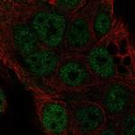 TOR4A Antibody in Immunocytochemistry (ICC/IF)