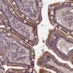 TOR4A Antibody in Immunohistochemistry (IHC)