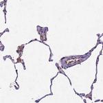 TOR4A Antibody in Immunohistochemistry (IHC)