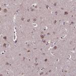 TOR4A Antibody in Immunohistochemistry (IHC)