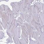 COBLL1 Antibody in Immunohistochemistry (IHC)