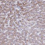 ATPAF1 Polyclonal Antibody