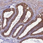 LZTS2 Antibody in Immunohistochemistry (Paraffin) (IHC (P))
