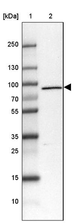 LZTS2 Antibody in Western Blot (WB)