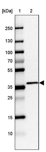 C2orf72 Antibody in Western Blot (WB)