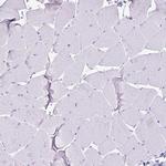 Cystatin M Antibody in Immunohistochemistry (Paraffin) (IHC (P))