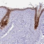 Cystatin M Antibody in Immunohistochemistry (Paraffin) (IHC (P))