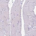 Cystatin M Antibody in Immunohistochemistry (IHC)