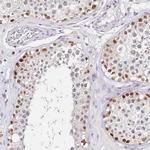 LSM3 Antibody in Immunohistochemistry (IHC)