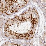 HMCES Antibody in Immunohistochemistry (Paraffin) (IHC (P))