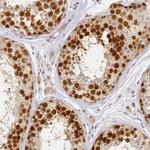 HMCES Antibody in Immunohistochemistry (IHC)