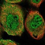 TRIM26 Polyclonal Antibody