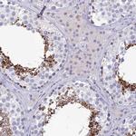 GOLGA6A Polyclonal Antibody