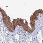 THAP4 Polyclonal Antibody