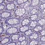 RNASE2 Antibody in Immunohistochemistry (Paraffin) (IHC (P))