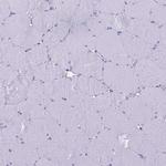 RNASE2 Antibody in Immunohistochemistry (Paraffin) (IHC (P))