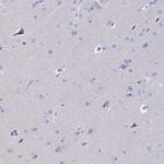 RNASE2 Antibody in Immunohistochemistry (IHC)