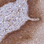 OR5T3 Polyclonal Antibody