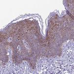 SPRYD5 Polyclonal Antibody