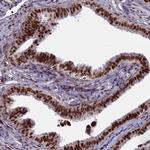 ZNF707 Antibody in Immunohistochemistry (Paraffin) (IHC (P))