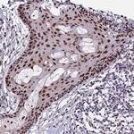 ZNF707 Antibody in Immunohistochemistry (Paraffin) (IHC (P))