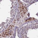 ZNF707 Antibody in Immunohistochemistry (Paraffin) (IHC (P))