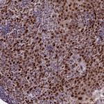 ZNF707 Antibody in Immunohistochemistry (Paraffin) (IHC (P))