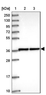 ZNF707 Antibody in Western Blot (WB)