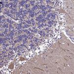 CALML3 Antibody in Immunohistochemistry (Paraffin) (IHC (P))
