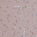 CALML3 Antibody in Immunohistochemistry (Paraffin) (IHC (P))