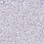 CALML3 Antibody in Immunohistochemistry (Paraffin) (IHC (P))