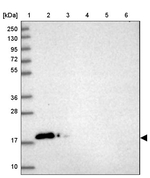 CALML3 Antibody in Western Blot (WB)