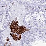 OR4D5 Polyclonal Antibody