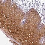 PNMA6A Polyclonal Antibody