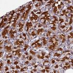 TTC5 Polyclonal Antibody