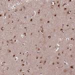 SLC22A24 Antibody in Immunohistochemistry (Paraffin) (IHC (P))