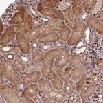 SLC22A24 Polyclonal Antibody